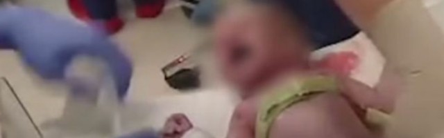 Snimljena pluća bebe pri prvom udisaju: Komplikovano je (VIDEO)