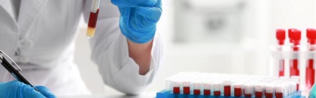 Šta znači kad su limfociti niski, šta kad su povišeni