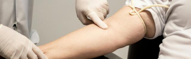 Udruženje "Žena uz ženu" u misiji kupovine TRAGAČA VENA za onkologiju UKC Kragujevac: Frizerski i kozmetički saloni pozvani da se postanu deo mreže humanosti