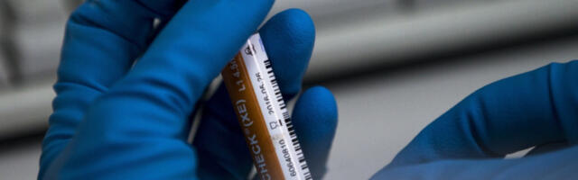 USKORO VAKCINA PROTIV HIV?! Nemački naučnici pronašli antitelo koje sprečava zarazu