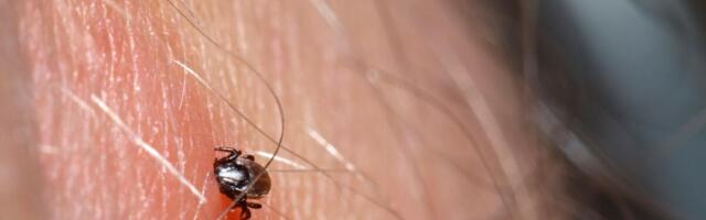 Kako bezbedno izvaditi krpelja? Narodne metode i uvrtanje u smeru kazaljke na satu mogu opasno ugroziti zdravlje