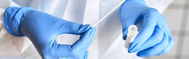 Četvoro umrlih, zaraženo 73