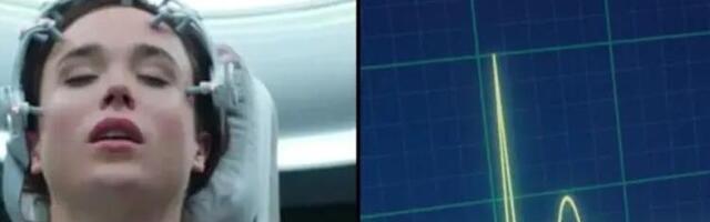 Naučnici po prvi put očitali moždane signale nakon smrti