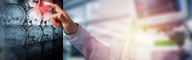 Prva tri sata su presudna: Prepoznajte MOŽDANI UDAR