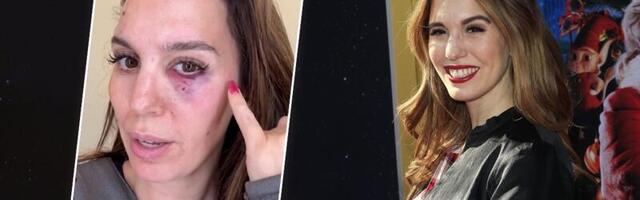 (VIDEO) Slavna glumica upucana u oko!