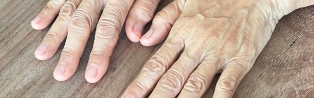 Znaci koji upozoravaju na lošu cirkulaciju: Pripisujemo umoru i stresu, a stanje je daleko ozbiljnije