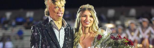 Čudesni život Dilana Milsa: Preživeo požar sa 84% opekotina na telu, 16 godina kasnije osvojio je prestižnu titulu