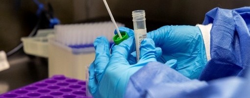 U SAD nastavljeni klinički testovi vakcine Astra Zeneka/Oksford protiv korona virusa