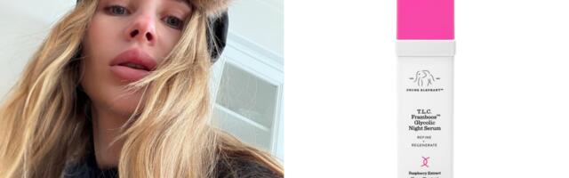 Ujednačen ten i koža koja blista? Moguće je – uz ove serume