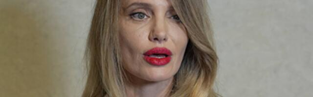 LJUDI, ŠTA JE S GLUMICOM? Pojavila se JEZIVA TEORIJA nakon slika OSUŠENOG TELA i DEFORMISANE GLAVE! (FOTO)