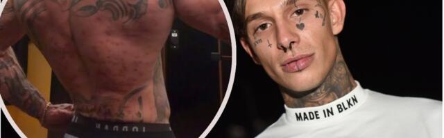 ŠTA SE DOGODILO SA LEĐIMA NEKADAŠNJEG ZADRUGARA? Svi gledaju u jedan detalj i pitaju se da li je sve okej