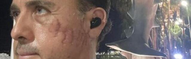 "Kad je zatvorila čeljust, osetio sam pritisak ugriza" Čoveka NAPALA AJKULA, progutala mu glavu, onda počela da...