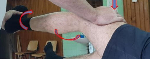Povreda prednje ukrštene veze kolena