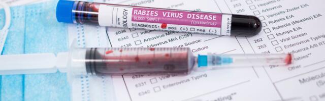 HOROR Amerikanac preminuo od besnila: Posle transplantacije bubrega zaraženog donora