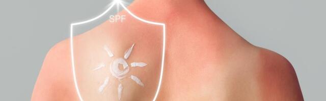 SPF 30 ili 50: Šta broj na kremi za sunčanje zaista govori i gde ljudi najčešće greše