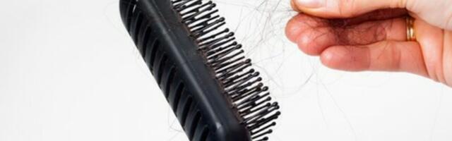 SVE SRPKINJE RADE ONO ZBOG ČEGA KOSA OPADA KAO LUDA: Prestanite sa time ODMAH!