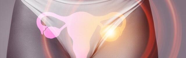 Policistični jajnici nisu samo ginekološki problem: Evo do čega još mogu da dovedu – ne bira kilažu