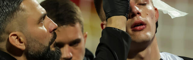 Važne vesti za Blagojevića pred drugi debi - Evo kako je Roganović posle udarca u glavu