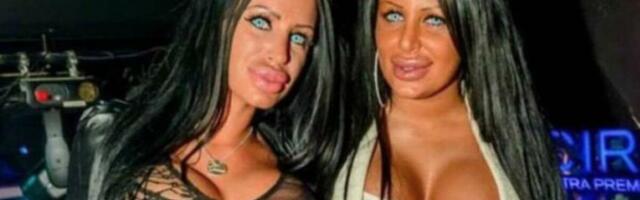 VIŠE NIJE KRALJICA SILIKONA! Imala PAČIJA USTA, OGROMNE GRUDI i JARKO PLAVA SOČIVA! Njena promena ŠOKIRA