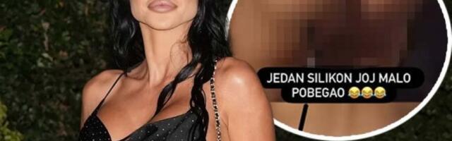 LJUDI, ŠTA SE DEŠAVA SA ZADNJICOM MAJE MARINKOVIĆ? Taki zabrinut zbog DEFORMISANIH silikona mezimice! (FOTO)