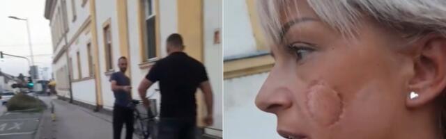 "Kad ju je ugrizao za obraz, mislila sam da će joj odgristi meso"! Ispovest žene koja je spasila Mitrovčanku (34) od bivšeg supruga (FOTO/VIDEO)