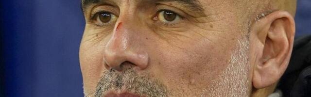 Šokantna scena, strašan prizor! Gvardiola krvav, modar, izgreban... (VIDEO/FOTO)