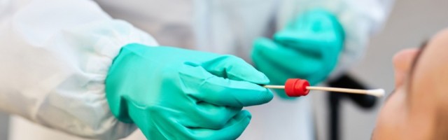 Kosovo: 12 mrtvih i 728 pozitivnih