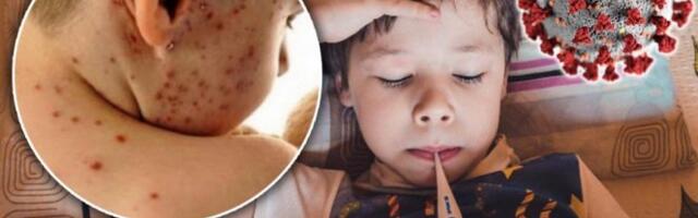 Alarm u srpskim vrtićima - Širi se virus! Roditelji u panici zbog opake zaraze, a evo koji je prvi simptom