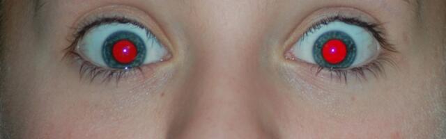 Zašto nedostatak crvenih očiju na fotografijama može biti znak ozbiljnog zdravstvenog problema