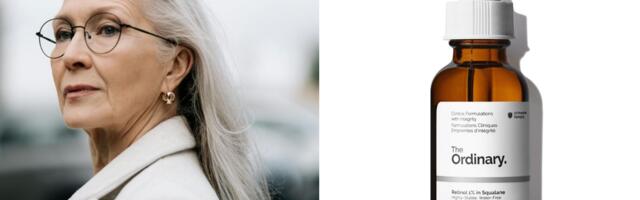 Fact Check: Da li stres zaista izaziva bore?