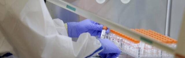 VAŽNO JE DA SE TESTIRATE IAKO STE MLADI, ZDRAVI I BEZ PRIDRUŽENIH BOLESTI! Dr Plavšić objašnjava: Zaraženi koronom treba da znaju ovo