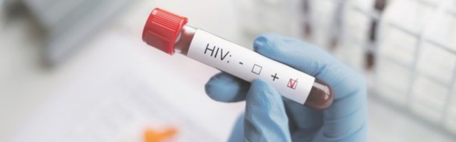 KONDOM GLAVU ČUVA - HIV i AIDS, 40 godina kasnije! INFEKTOLOG objašnjava šta se promenilo...
