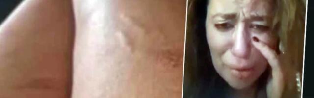 Ana Nikolić KRIŠOM SNIMILA Raleta u stanu dok se ZALEĆE KA NJOJ, celo telo u MODRICAMA, izgubila glas: "ZATVORIO MI JE OKO!" (VIDEO)
