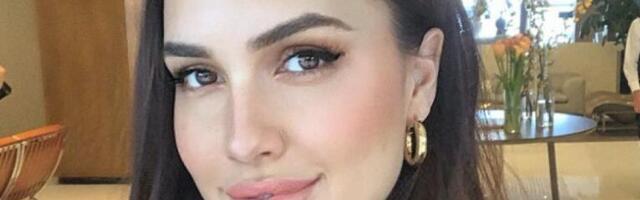 Preučena hrvatska pevačica? Izubijana i u modricama, JEZIV prizor! (FOTO)