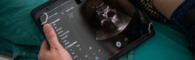 HITNOJ POMOĆI DONIRAN PORTABILNI ULTRAZVUČNI APARAT! Zdravstveni karavan Fondacije Mozzart krenuo iz Svilajnca!