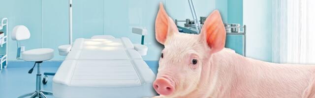 Transplantacije će totalno drugačije izgledati: Svinjski organi biće superiorniji od ljudskih