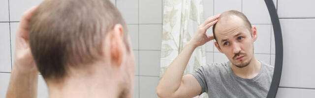 Da li muškarci ćelave ako stavljaju gel za kosu