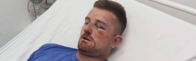 Nastavlja se etničko čišćenje: Srbin na KiM pretučen dok je čuvao stoku
