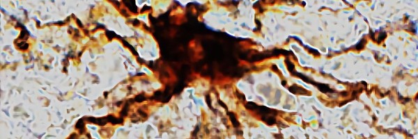 Zombi ćelije koje nastavljaju da žive nakon moždane smrti