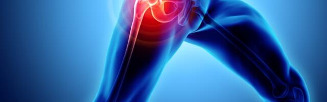 Ovo je najbolja vežba za kukove