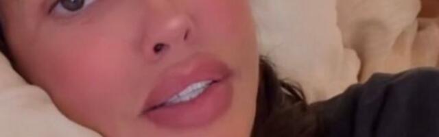 Dijana Dilajn još uvek u velikom problemu, mimika lica se ne vraća ni posle dva meseca: Usnimila sve