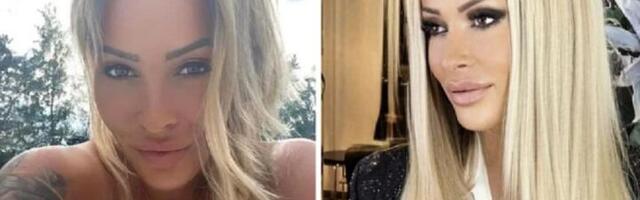 Gospođa Šumaher deli svoje gole slike i zarađuje (FOTO)