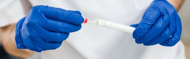 Novim lekom brzo izlečeno 29 od 30 obolelih od korone