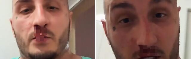 Srpski reper usred noći objavio jeziv snimak! Krv mu se sliva niz lice, spomenuo batine