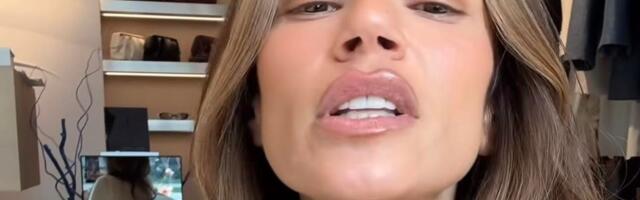 Danijela Dimitrovska u modricama i podlivima: Dok se snimala videli se hematomi na vratu, ona se brzo oglasila