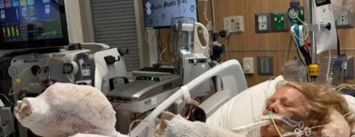 Žena zaspala pored bazena na +40 stepeni: Izgorela do kostiju, lekari joj se bore za život