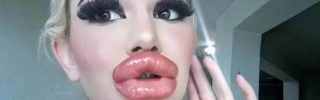 Šta uradi, sestro: Žena s najvećim usnama na svetu