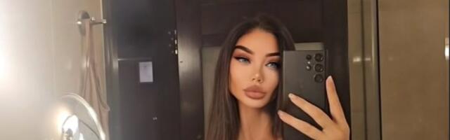 "Da li ova žena ima oči?!" Soraja FOTOŠOPOM umanjila delove tela, SVI ODMAH POJURILI U KOMENTARE! (FOTO)