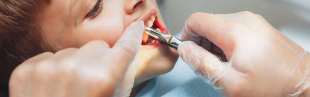 Veza iznenadila naučnike: Pokvareni zubi u detinjstvu povezani sa srčanim bolestima kasnije u životu