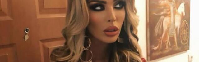 "BOJIM SE ZA SVOJ ŽIVOT" Ava Karabatić prijavila dečka policiji, objavila uznemirujuće slike povreda - ilce celo izgrebano, podlivi i modrice (FOTO)